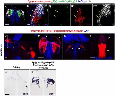 Overexpression of Spexin 1 in the Dorsal Habenula Reduces Anxiety in Zebrafish